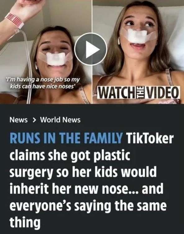 태어날 자식을 위해 코 성형을 한 틱톡커
